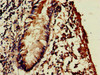 Immunohistochemistry of paraffin-embedded human appendix tissue using CSB-PA897589LA01HU at dilution of 1:100