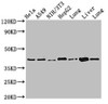 Western Blot<br />
 Positive WB detected in: Hela whole cell lysate, A549 whole cell lysate, NIH/3T3 whole cell lysate, HepG2 whole cell lysate, Rat lung tissue, Mouse liver tissue, Mouse lung tissue<br />
 All lanes: ACAA2 antibody at 2.4µg/ml<br />
 Secondary<br />
 Goat polyclonal to rabbit IgG at 1/50000 dilution<br />
 Predicted band size: 42 kDa<br />
 Observed band size: 42 kDa<br />