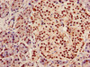 Immunohistochemistry of paraffin-embedded human pancreatic tissue using CSB-PA001453LA01HU at dilution of 1:100