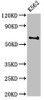 Western Blot<br />
 Positive WB detected in: K562 whole cell lysate<br />
 All lanes: BCHE antibody at 3µg/ml<br />
 Secondary<br />
 Goat polyclonal to rabbit IgG at 1/50000 dilution<br />
 Predicted band size: 69 kDa<br />
 Observed band size: 69 kDa<br />