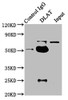Immunoprecipitating DLAT in HepG2 whole cell lysate<br />
 Lane 1: Rabbit control IgG instead of CSB-PA006926LA01HU in HepG2 whole cell lysate.
 For western blotting, a HRP-conjugated Protein G antibody was used as the secondary antibody (1/2000) <br />
 Lane 2: CSB-PA006926LA01HU (6µg) + HepG2 whole cell lysate (1mg) <br />
 Lane 3: HepG2 whole cell lysate (20µg) <br /> Immunoprecipitating DLAT in HepG2 whole cell lysate<br />
 Lane 1: Rabbit control IgG instead of CSB-PA006926LA01HU in HepG2 whole cell lysate.
 For western blotting, a HRP-conjugated Protein G antibody was used as the secondary antibody (1/2000) <br />
 Lane 2: CSB-PA006926LA01HU (6µg) + HepG2 whole cell lysate (1mg) <br />
 Lane 3: HepG2 whole cell lysate (20µg) <br />