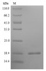 (Tris-Glycine gel) Discontinuous SDS-PAGE (reduced) with 5% enrichment gel and 15% separation gel.