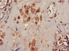 Immunohistochemistry of paraffin-embedded human placenta tissue using CSB-PA012062LA01HU at dilution of 1:100