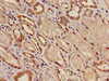 Immunohistochemistry of paraffin-embedded human kidney tissue using CSB-PA012062LA01HU at dilution of 1:100