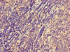Immunohistochemistry of paraffin-embedded human lymph node tissue using CSB-PA015549LA01HU at dilution of 1:100 Immunohistochemistry of paraffin-embedded human lymph node tissue using CSB-PA015549LA01HU at dilution of 1:100