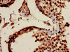 Immunohistochemistry of paraffin-embedded human testis tissue using CSB-PA613694LA01HU at dilution of 1:100