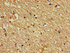 Immunohistochemistry of paraffin-embedded human brain tissue using CSB-PA614975YA01HU at dilution of 1:100