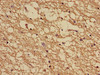 Immunohistochemistry of paraffin-embedded human brain tissue using CSB-PA614988LA01HU at dilution of 1:100