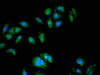 Immunofluorescent analysis of A549 cells using CSB-PA846292LA01HU at dilution of 1:100 and Alexa Fluor 488-congugated AffiniPure Goat Anti-Rabbit IgG (H+L)