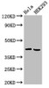 Western Blot<br />
 Positive WB detected in: Hela whole cell lysate, HEK293 whole cell lysate<br />
 All lanes: ARPC1A antibody at 4µg/ml<br />
 Secondary<br />
 Goat polyclonal to rabbit IgG at 1/50000 dilution<br />
 Predicted band size: 42, 39 kDa<br />
 Observed band size: 42 kDa<br />