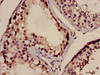 Immunohistochemistry of paraffin-embedded human testis tissue using CSB-PA859098LA01HU at dilution of 1:100