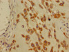 Immunohistochemistry of paraffin-embedded human placenta tissue using CSB-PA890663LA01HU at dilution of 1:100