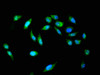 Immunofluorescent analysis of Hela cells using CSB-PA892157LA01HU at dilution of 1:100 and Alexa Fluor 488-congugated AffiniPure Goat Anti-Rabbit IgG (H+L)