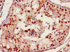 Immunohistochemistry of paraffin-embedded human testis tissue using CSB-PA008828HA01HU at dilution of 1:100