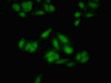 Immunofluorescent analysis of Hela cells using CSB-PA013687LA01HU at dilution of 1:100 and Alexa Fluor 488-congugated AffiniPure Goat Anti-Rabbit IgG (H+L)