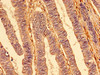 IHC image of CSB-PA023964LA01HU diluted at 1:400 and staining in paraffin-embedded human colon cancer performed on a Leica BondTM system. After dewaxing and hydration, antigen retrieval was mediated by high pressure in a citrate buffer (pH 6.0) . Section was blocked with 10% normal goat serum 30min at RT. Then primary antibody (1% BSA) was incubated at 4°C overnight. The primary is detected by a biotinylated secondary antibody and visualized using an HRP conjugated SP system.