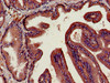 Immunohistochemistry of paraffin-embedded human prostate tissue using CSB-PA06229A0Rb at dilution of 1:100