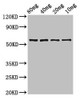 Western Blot<br />
 Positive WB detected in Recombinant protein<br />
 All lanes: phr antibody at 3.4µg/ml<br />
 Secondary<br />
 Goat polyclonal to rabbit IgG at 1/50000 dilution<br />
 Predicted band size: 60 kDa<br />
 Observed band size: 60 kDa<br />