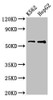 Western Blot<br />
 Positive WB detected in: K562 whole cell lysate, HepG2 whole cell lysate<br />
 All lanes: FSCN1 antibody at 3.2µg/ml<br />
 Secondary<br />
 Goat polyclonal to rabbit IgG at 1/50000 dilution<br />
 Predicted band size: 55 kDa<br />
 Observed band size: 55 kDa<br />