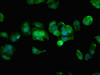 Immunofluorescent analysis of MCF-7 cells using CSB-PA872492LA01HU at dilution of 1:100 and Alexa Fluor 488-congugated AffiniPure Goat Anti-Rabbit IgG (H+L) Immunofluorescent analysis of MCF-7 cells using CSB-PA872492LA01HU at dilution of 1:100 and Alexa Fluor 488-congugated AffiniPure Goat Anti-Rabbit IgG (H+L)