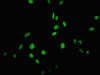 Immunofluorescent analysis of Hela cells using CSB-PA891982LA01HU at dilution of 1:100 and Alexa Fluor 488-congugated AffiniPure Goat Anti-Rabbit IgG (H+L)