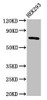 Western Blot<br />
 Positive WB detected in: HEK293 whole cell lysate<br />
 All lanes: AACS antibody at 2.5µg/ml<br />
 Secondary<br />
 Goat polyclonal to rabbit IgG at 1/50000 dilution<br />
 Predicted band size: 76, 68, 31 kDa<br />
 Observed band size: 76 kDa<br />