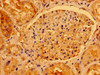 Immunohistochemistry of paraffin-embedded human kidney tissue using CSB-PA001012LA01HU at dilution of 1:100