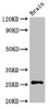Western Blot<br />
 Positive WB detected in: Rat brain tissue<br />
 All lanes: ASCL1 antibody at 3µg/ml<br />
 Secondary<br />
 Goat polyclonal to rabbit IgG at 1/50000 dilution<br />
 Predicted band size: 26 kDa<br />
 Observed band size: 26 kDa<br />