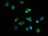 Immunofluorescence staining of MCF-7 cells with CSB-PA003434LA01HU at 1:166, counter-stained with DAPI. The cells were fixed in 4% formaldehyde, permeabilized using 0.2% Triton X-100 and blocked in 10% normal Goat Serum. The cells were then incubated with the antibody overnight at 4°C. The secondary antibody was Alexa Fluor 488-congugated AffiniPure Goat Anti-Rabbit IgG (H+L) .