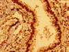 Immunohistochemistry of paraffin-embedded human lung tissue using CSB-PA007385LA01HU at dilution of 1:100