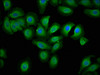 Immunofluorescence staining of A549 cells with CSB-PA007385LA01HU at 1:133, counter-stained with DAPI. The cells were fixed in 4% formaldehyde, permeabilized using 0.2% Triton X-100 and blocked in 10% normal Goat Serum. The cells were then incubated with the antibody overnight at 4°C. The secondary antibody was Alexa Fluor 488-congugated AffiniPure Goat Anti-Rabbit IgG (H+L) .
