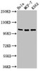 Western Blot<br />
 Positive WB detected in: Hela whole cell lysate, MCF-7 whole cell lysate, K562 whole cell lysate<br />
 All lanes: EVC antibody at 2µg/ml<br />
 Secondary<br />
 Goat polyclonal to rabbit IgG at 1/50000 dilution<br />
 Predicted band size: 112 kDa<br />
 Observed band size: 112 kDa<br /> Western Blot<br />
 Positive WB detected in: Hela whole cell lysate, MCF-7 whole cell lysate, K562 whole cell lysate<br />
 All lanes: EVC antibody at 2µg/ml<br />
 Secondary<br />
 Goat polyclonal to rabbit IgG at 1/50000 dilution<br />
 Predicted band size: 112 kDa<br />
 Observed band size: 112 kDa<br />