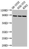 Western Blot<br />
 Positive WB detected in: SH-SY5Y whole cell lysate, NIH/3T3 whole cell lysate, K562 whole cell lysate<br />
 All lanes: NTRK1 antibody at 2.7µg/ml<br />
 Secondary<br />
 Goat polyclonal to rabbit IgG at 1/50000 dilution<br />
 Predicted band size: 88, 87, 84, 78 kDa<br />
 Observed band size: 88 kDa<br />