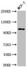 Western Blot<br />
 Positive WB detected in: MCF-7 whole cell lysate<br />
 All lanes: PSD antibody at 3.2µg/ml<br />
 Secondary<br />
 Goat polyclonal to rabbit IgG at 1/50000 dilution<br />
 Predicted band size: 110, 71 kDa<br />
 Observed band size: 110 kDa<br />