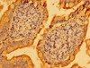 Immunohistochemistry of paraffin-embedded human small intestine tissue using CSB-PA018842LA01HU at dilution of 1:100