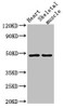 Western Blot<br />
 Positive WB detected in: Mouse heart tissue, Mouse skeletal muscle tissue<br />
 All lanes: CD36 antibody at 2µg/ml<br />
 Secondary<br />
 Goat polyclonal to rabbit IgG at 1/50000 dilution<br />
 Predicted band size: 54, 33, 49, 47 kDa<br />
 Observed band size: 49 kDa<br />