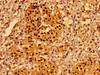 Immunohistochemistry of paraffin-embedded human adrenal gland tissue using CSB-PA747468LA01HU at dilution of 1:100