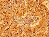 Immunohistochemistry of paraffin-embedded human adrenal gland tissue using CSB-PA815557LA01HU at dilution of 1:100