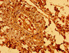 Immunohistochemistry of paraffin-embedded human lung tissue using CSB-PA868389LA01HU at dilution of 1:100