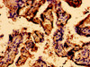 Immunohistochemistry of paraffin-embedded human placenta tissue using CSB-PA873707LA01HU at dilution of 1:100
