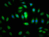 Immunofluorescence staining of A549 cells with CSB-PA873707LA01HU at 1:200, counter-stained with DAPI. The cells were fixed in 4% formaldehyde, permeabilized using 0.2% Triton X-100 and blocked in 10% normal Goat Serum. The cells were then incubated with the antibody overnight at 4°C. The secondary antibody was Alexa Fluor 488-congugated AffiniPure Goat Anti-Rabbit IgG (H+L) .