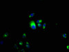 Immunofluorescence staining of MCF-7 cells with CSB-PA006047LA01HU at 1:66, counter-stained with DAPI. The cells were fixed in 4% formaldehyde, permeabilized using 0.2% Triton X-100 and blocked in 10% normal Goat Serum. The cells were then incubated with the antibody overnight at 4°C. The secondary antibody was Alexa Fluor 488-congugated AffiniPure Goat Anti-Rabbit IgG (H+L) . Immunofluorescence staining of MCF-7 cells with CSB-PA006047LA01HU at 1:66, counter-stained with DAPI. The cells were fixed in 4% formaldehyde, permeabilized using 0.2% Triton X-100 and blocked in 10% normal Goat Serum. The cells were then incubated with the antibody overnight at 4°C. The secondary antibody was Alexa Fluor 488-congugated AffiniPure Goat Anti-Rabbit IgG (H+L) .