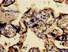 Immunohistochemistry of paraffin-embedded human placenta tissue using CSB-PA008791LA01HU at dilution of 1:100 Immunohistochemistry of paraffin-embedded human placenta tissue using CSB-PA008791LA01HU at dilution of 1:100
