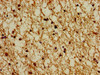 Immunohistochemistry of paraffin-embedded human brain tissue using CSB-PA018921LA01HU at dilution of 1:100