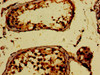 Immunohistochemistry of paraffin-embedded human testis tissue using CSB-PA618787LA01HU at dilution of 1:100