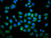 Immunofluorescence staining of Hela cells with CSB-PA619864LA01HU at 1:66, counter-stained with DAPI. The cells were fixed in 4% formaldehyde, permeabilized using 0.2% Triton X-100 and blocked in 10% normal Goat Serum. The cells were then incubated with the antibody overnight at 4°C. The secondary antibody was Alexa Fluor 488-congugated AffiniPure Goat Anti-Rabbit IgG (H+L) .