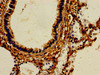 Immunohistochemistry of paraffin-embedded human lung tissue using CSB-PA624122LA01HU at dilution of 1:100