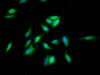 Immunofluorescence staining of Hela cells with CSB-PA666241LA01HU at 1:66, counter-stained with DAPI. The cells were fixed in 4% formaldehyde, permeabilized using 0.2% Triton X-100 and blocked in 10% normal Goat Serum. The cells were then incubated with the antibody overnight at 4°C. The secondary antibody was Alexa Fluor 488-congugated AffiniPure Goat Anti-Rabbit IgG (H+L) .