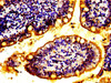 IHC image of CSB-PA873704LA01HU diluted at 1:100 and staining in paraffin-embedded human small intestine tissue performed on a Leica BondTM system. After dewaxing and hydration, antigen retrieval was mediated by high pressure in a citrate buffer (pH 6.0) . Section was blocked with 10% normal goat serum 30min at RT. Then primary antibody (1% BSA) was incubated at 4°C overnight. The primary is detected by a biotinylated secondary antibody and visualized using an HRP conjugated SP system.
