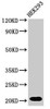 Western Blot<br />
 Positive WB detected in: HEK293 whole cell lysate<br />
 All lanes: RPS10P5 antibody at 2µg/ml<br />
 Secondary<br />
 Goat polyclonal to rabbit IgG at 1/50000 dilution<br />
 Predicted band size: 21 kDa<br />
 Observed band size: 21 kDa<br />